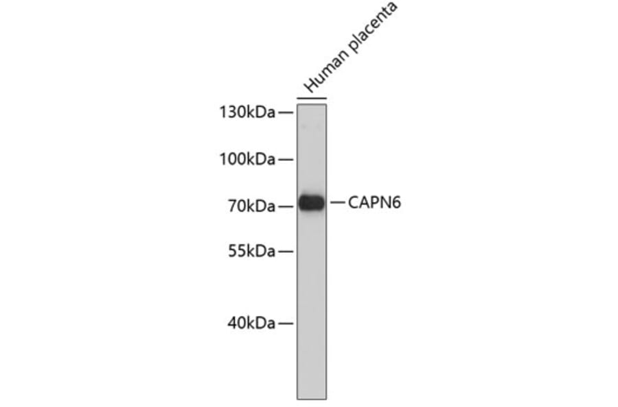 Western Blot - Anti-CAPN6 Antibody (A3775) - Antibodies.com