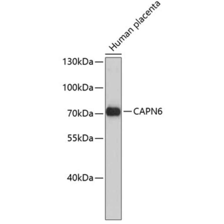 Western Blot - Anti-CAPN6 Antibody (A3775) - Antibodies.com