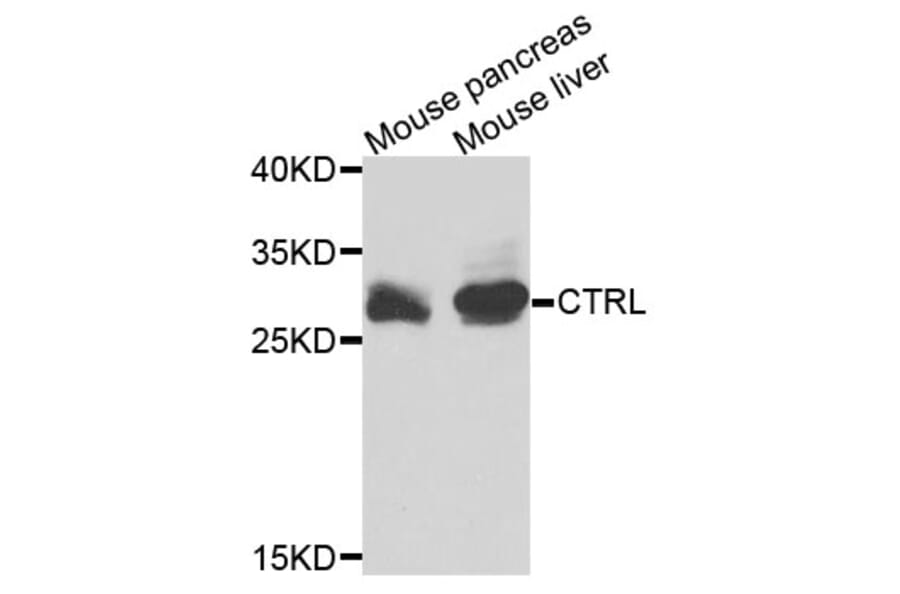 Western Blot - Anti-CTRL Antibody (A3818) - Antibodies.com