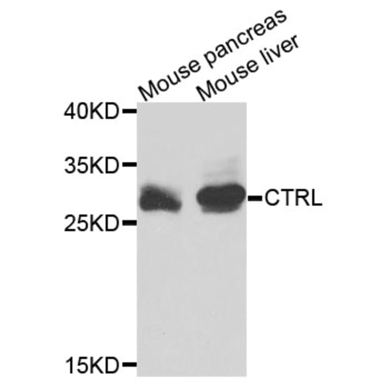 Western Blot - Anti-CTRL Antibody (A3818) - Antibodies.com