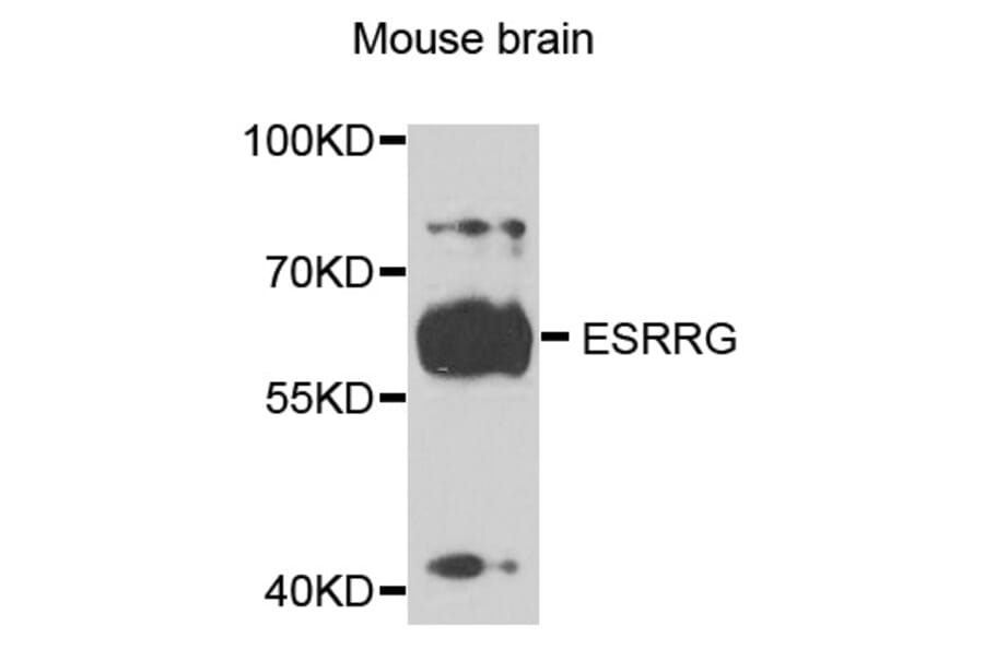 Western Blot - Anti-ESRRG Antibody (A3853) - Antibodies.com