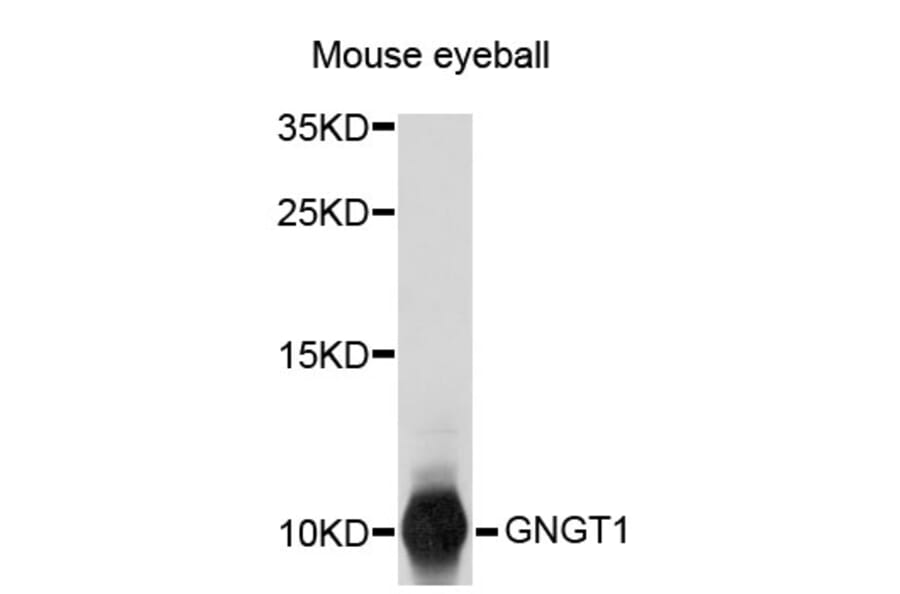 Western Blot - Anti-GNGT1 Antibody (A3890) - Antibodies.com