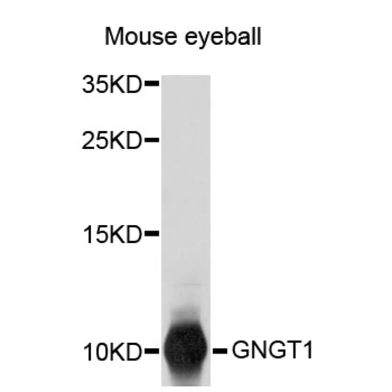Western Blot - Anti-GNGT1 Antibody (A3890) - Antibodies.com