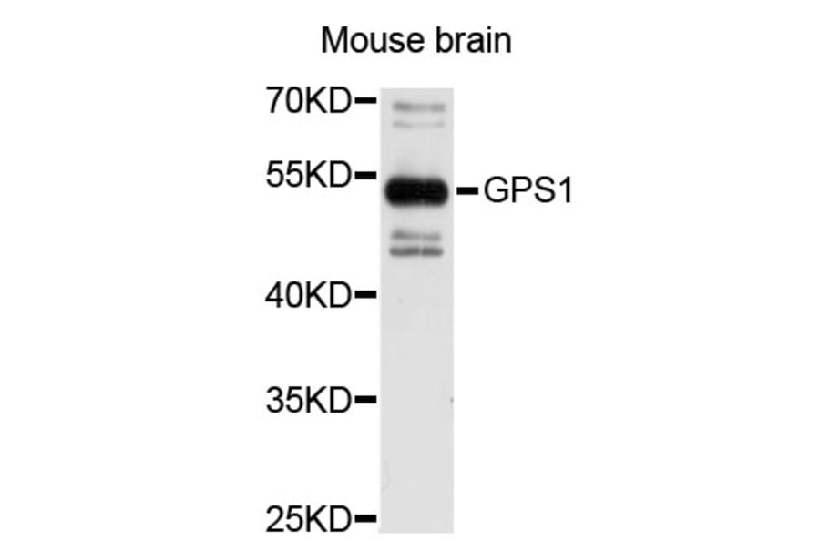 Western Blot - Anti-GPS1 Antibody (A3900) - Antibodies.com