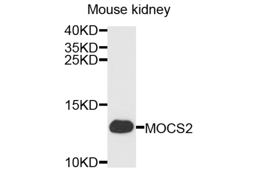 Western Blot - Anti-MOCS2 Antibody (A3965) - Antibodies.com