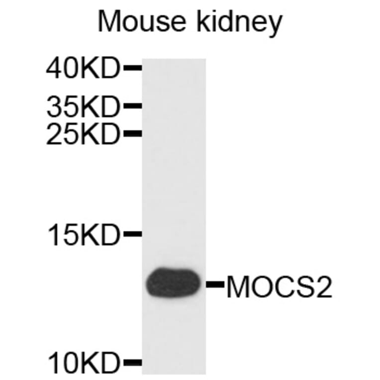 Western Blot - Anti-MOCS2 Antibody (A3965) - Antibodies.com