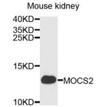 Western Blot - Anti-MOCS2 Antibody (A3965) - Antibodies.com