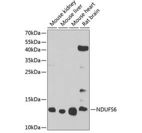 Western Blot - Anti-NDUFS6 Antibody (A17040) - Antibodies.com