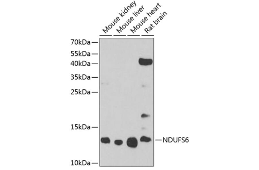 Western Blot - Anti-NDUFS6 Antibody (A17040) - Antibodies.com