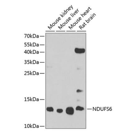 Western Blot - Anti-NDUFS6 Antibody (A17040) - Antibodies.com