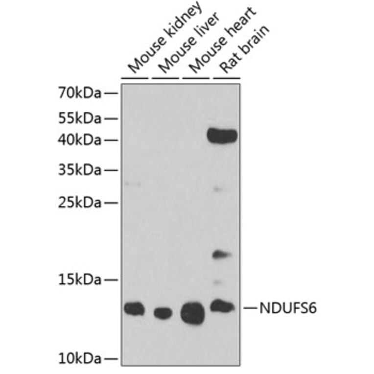 Western Blot - Anti-NDUFS6 Antibody (A17040) - Antibodies.com
