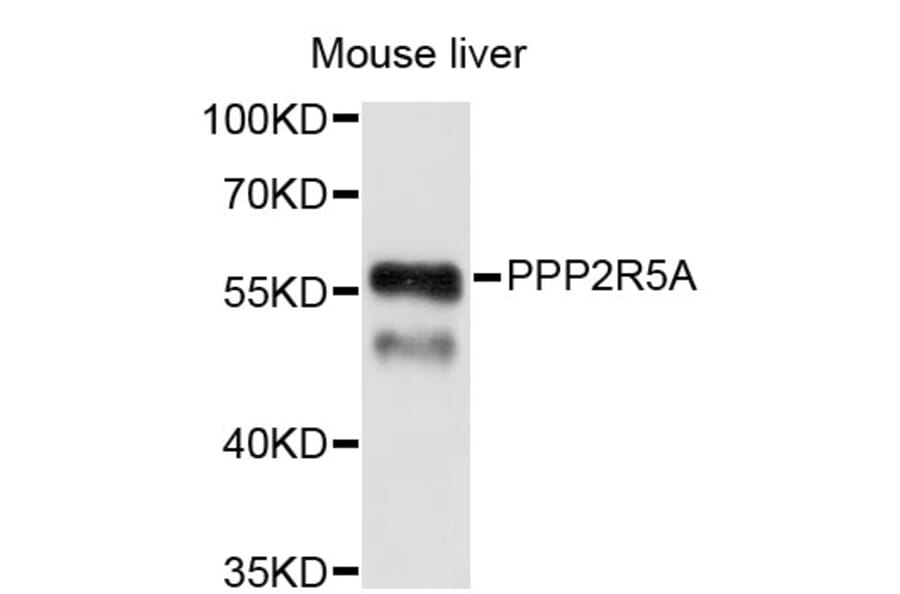 Western Blot - Anti-PPP2R5A Antibody (A4037) - Antibodies.com