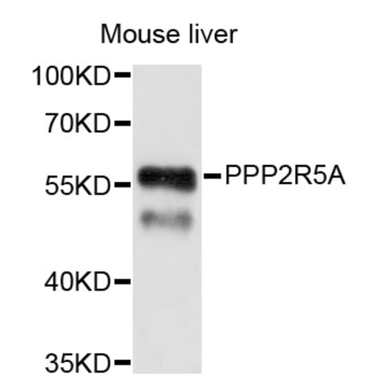 Western Blot - Anti-PPP2R5A Antibody (A4037) - Antibodies.com
