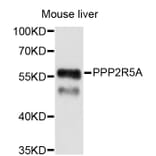 Western Blot - Anti-PPP2R5A Antibody (A4037) - Antibodies.com