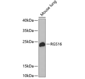 Western Blot - Anti-RGS16 Antibody (A17043) - Antibodies.com