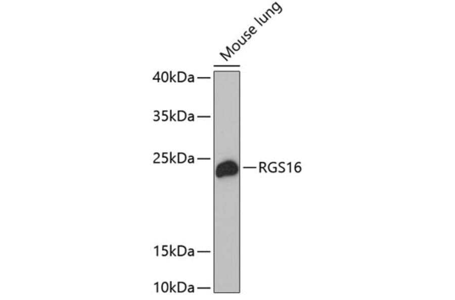 Western Blot - Anti-RGS16 Antibody (A17043) - Antibodies.com