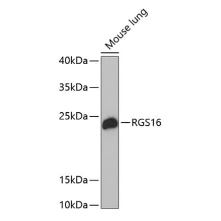Western Blot - Anti-RGS16 Antibody (A17043) - Antibodies.com