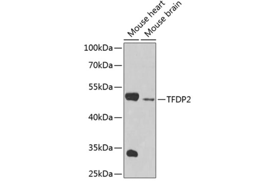 Western Blot - Anti-TFDP2 Antibody (A4152) - Antibodies.com