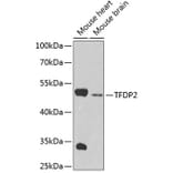 Western Blot - Anti-TFDP2 Antibody (A4152) - Antibodies.com