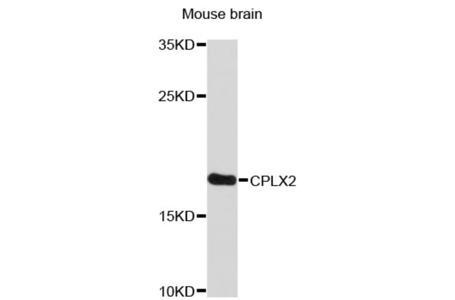 Western Blot - Anti-CPLX2 Antibody (A4456) - Antibodies.com
