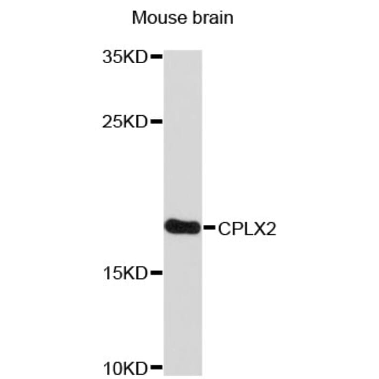 Western Blot - Anti-CPLX2 Antibody (A4456) - Antibodies.com