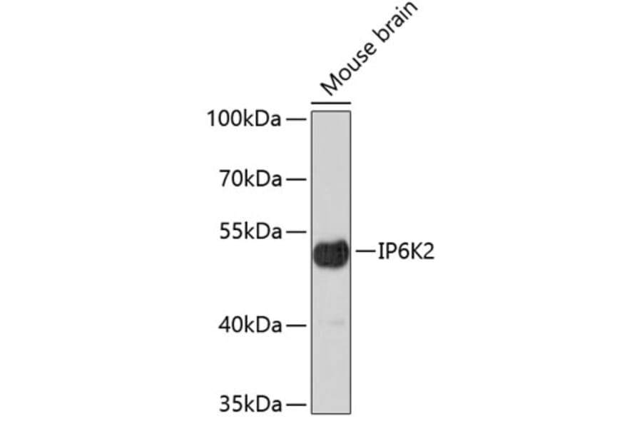 Western Blot - Anti-IP6K2 Antibody (A4738) - Antibodies.com