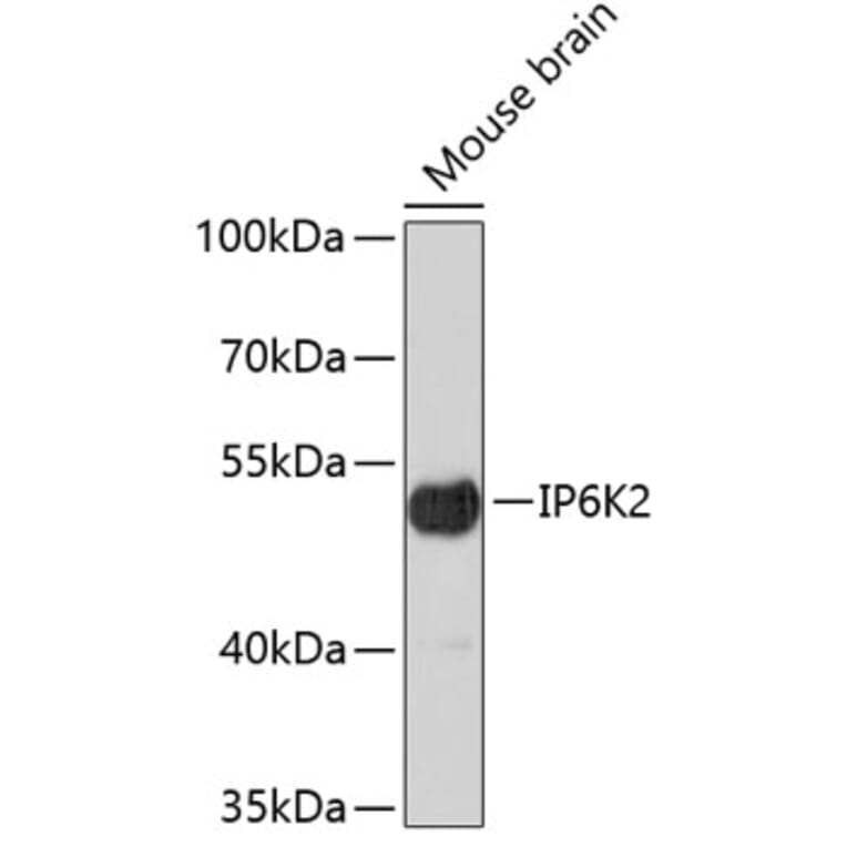 Western Blot - Anti-IP6K2 Antibody (A4738) - Antibodies.com