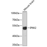 Western Blot - Anti-IP6K2 Antibody (A4738) - Antibodies.com