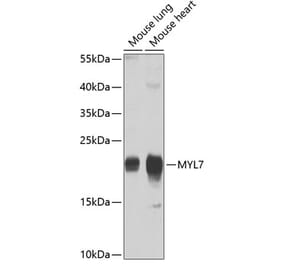 Western Blot - Anti-MYL7 Antibody (A17051) - Antibodies.com