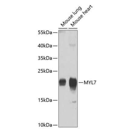 Western Blot - Anti-MYL7 Antibody (A17051) - Antibodies.com