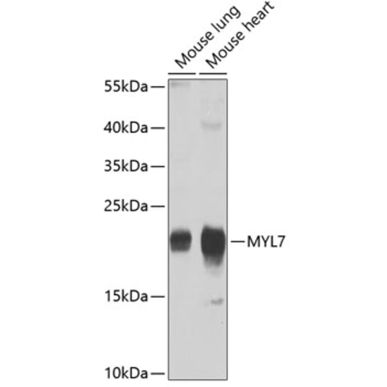 Western Blot - Anti-MYL7 Antibody (A17051) - Antibodies.com