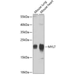 Western Blot - Anti-MYL7 Antibody (A17051) - Antibodies.com