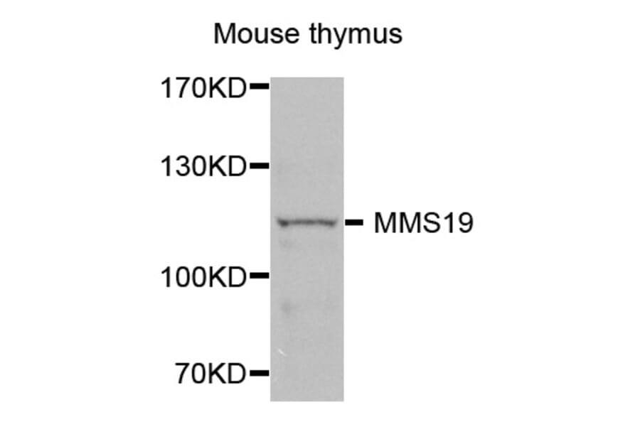 Western Blot - Anti-MMS19 Antibody (A4922) - Antibodies.com