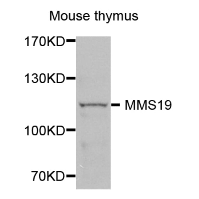 Western Blot - Anti-MMS19 Antibody (A4922) - Antibodies.com