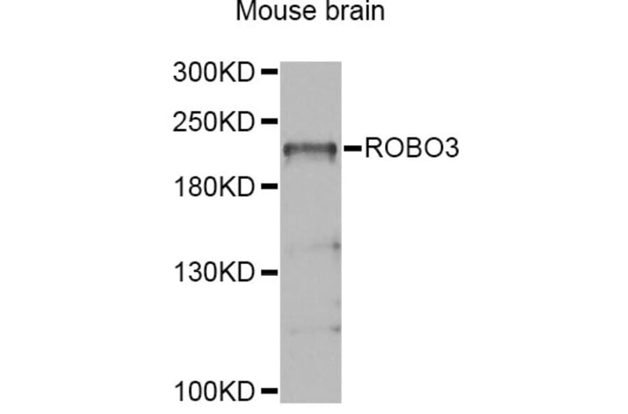 Western Blot - Anti-ROBO3 Antibody (A4924) - Antibodies.com