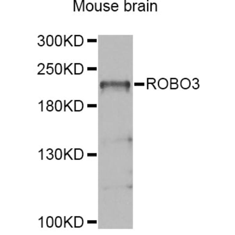 Western Blot - Anti-ROBO3 Antibody (A4924) - Antibodies.com