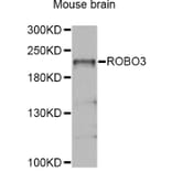 Western Blot - Anti-ROBO3 Antibody (A4924) - Antibodies.com