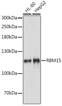 Western blot analysis of extracts of various cell lines, using Anti-RBM15 Antibody (A4936) at 1:1,000 dilution.
Secondary antibody: Goat Anti-Rabbit IgG (H+L) (HRP) (AS014) at 1:10,000 dilution.
Lysates / proteins: 25µg per lane.
Blocking buffer: 3% non-fat dry milk in TBST.
Detection: ECL Basic Kit (RM00020).
Exposure time: 30s.