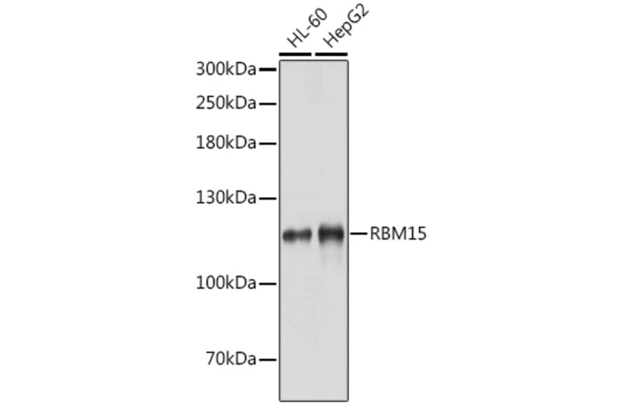 Western Blot - Anti-Rbm15/OTT Antibody (A17054) - Antibodies.com
