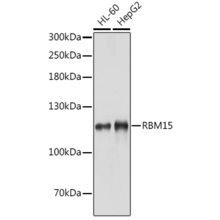 Western Blot - Anti-Rbm15/OTT Antibody (A17054) - Antibodies.com