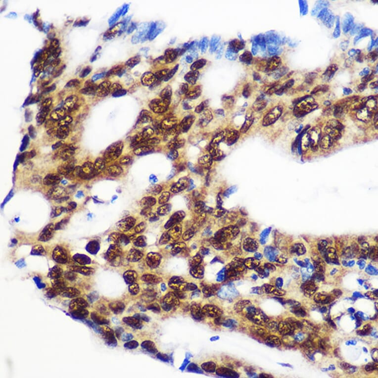 Immunohistochemistry - Anti-Rbm15/OTT Antibody (A17054) - Antibodies.com
