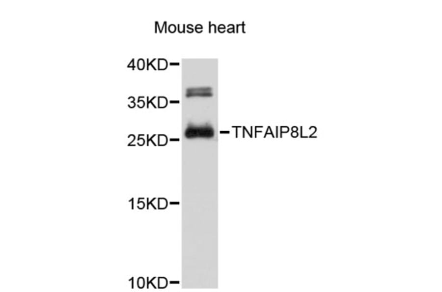 Western Blot - Anti-TNFAIP8L2 Antibody (A4974) - Antibodies.com