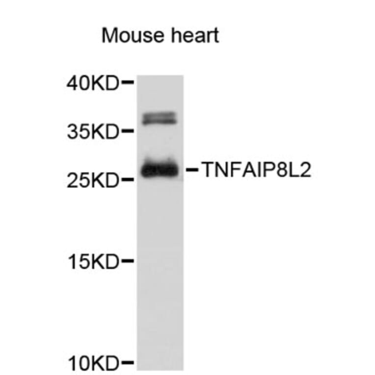 Western Blot - Anti-TNFAIP8L2 Antibody (A4974) - Antibodies.com