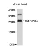 Western Blot - Anti-TNFAIP8L2 Antibody (A4974) - Antibodies.com