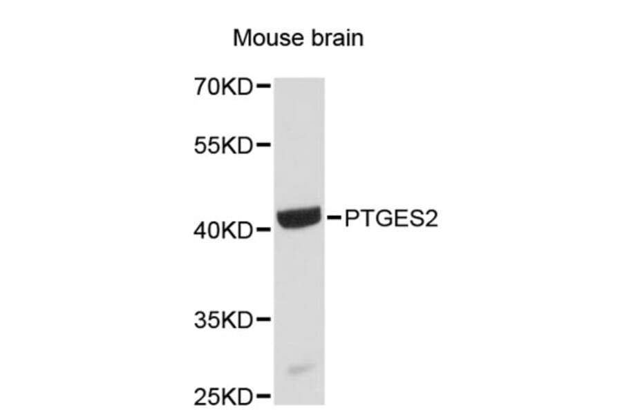 Western Blot - Anti-PTGES2 Antibody (A4993) - Antibodies.com