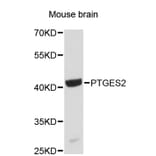 Western Blot - Anti-PTGES2 Antibody (A4993) - Antibodies.com