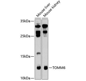 Western Blot - Anti-TOMM6 Antibody (A17062) - Antibodies.com