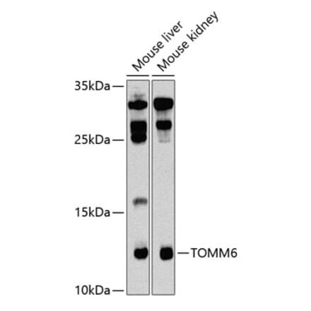 Western Blot - Anti-TOMM6 Antibody (A17062) - Antibodies.com