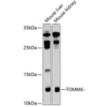 Western Blot - Anti-TOMM6 Antibody (A17062) - Antibodies.com
