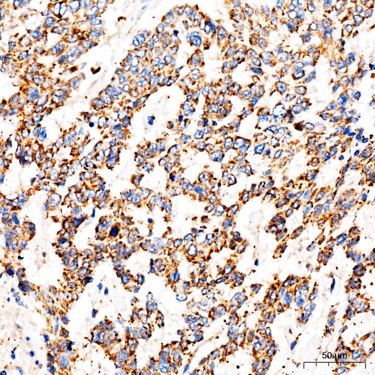 Immunohistochemistry - Anti-TOMM6 Antibody (A17062) - Antibodies.com